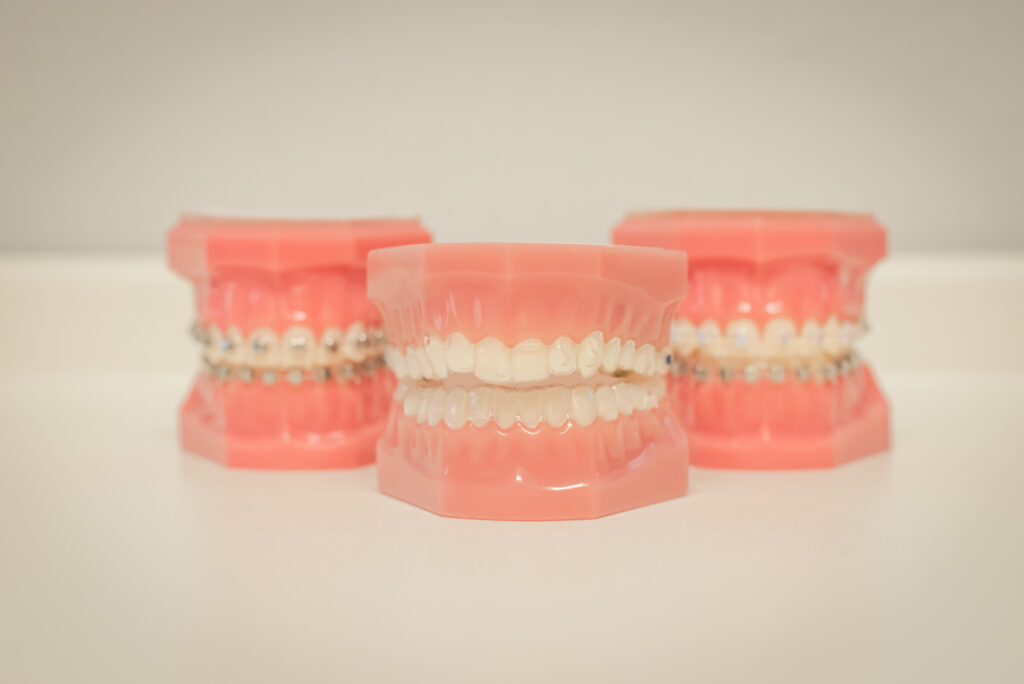 Orthodontie adultes